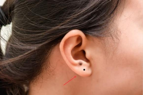 Trên người có 7 nốt ruồi này, số phú quý sung túc cả đời Tren nguoi co 7 not ruoi nay, so phu quy sung tuc ca doi