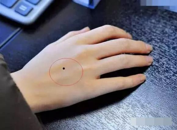 Điểm danh nốt ruồi trên tay tốt hay xấu - Hình 4 Diem danh not ruoi tren tay tot hay xau-Hinh-4