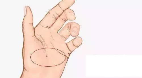 Điểm danh nốt ruồi trên tay tốt hay xấu Diem danh not ruoi tren tay tot hay xau