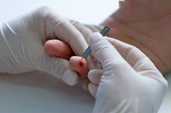 Người tiểu đường có thể sống trên 80 tuổi thường có đặc điểm này Nguoi tieu duong co the song tren 80 tuoi thuong co dac diem nay