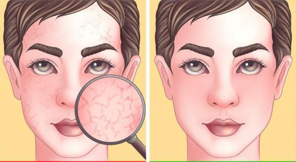6 lợi ích khi ăn trái cây yêu thích mà ít người biết - Hình 3 6 loi ich khi an trai cay yeu thich ma it nguoi biet-Hinh-3