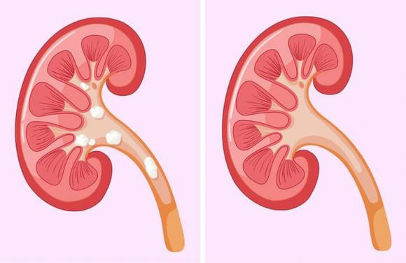 6 lợi ích khi ăn trái cây yêu thích mà ít người biết - Hình 4 6 loi ich khi an trai cay yeu thich ma it nguoi biet-Hinh-4