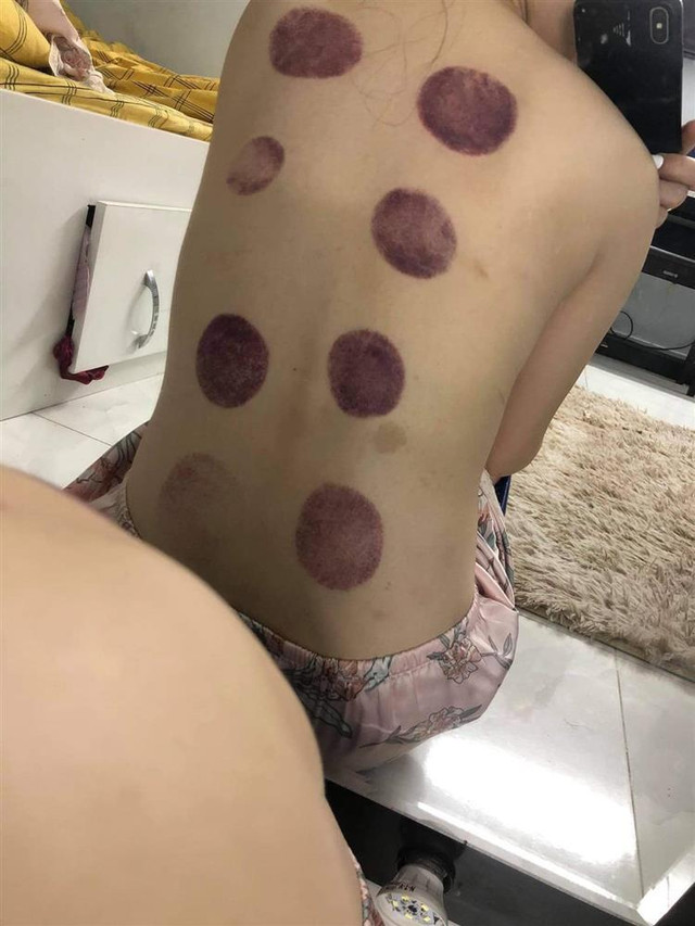 Chị vợ tố Gia Thị Linh tiểu tam tung ảnh thương tích đầy mình - Hình 6 Chi vo to Gia Thi Linh tieu tam tung anh thuong tich day minh-Hinh-6