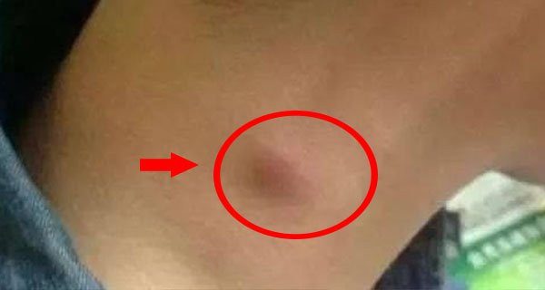 1 chậm, 2 lồi, 3 nhiều xuất hiện trên cơ thể cảnh báo phổi rất yếu 1 cham, 2 loi, 3 nhieu xuat hien tren co the canh bao phoi rat yeu