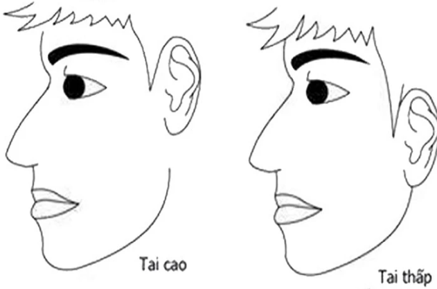 Nhìn tướng tai vài giây biết ngay vận mệnh giàu sang hay nghèo khó cả đời - Hình 2 Nhin tuong tai vai giay biet ngay van menh giau sang hay ngheo kho ca doi-Hinh-2