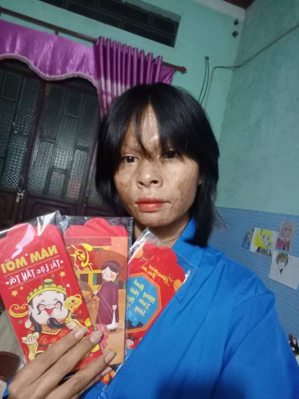 Học yêu bản thân từ những nỗi đau Hoc yeu ban than tu nhung noi dau