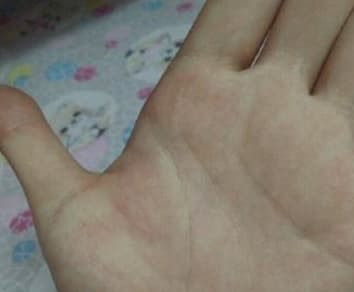 Tướng tay của người có số phận “khổ trước sướng sau“ - Hình 3 Tuong tay cua nguoi co so phan “kho truoc suong sau“-Hinh-3
