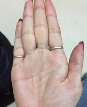 Tướng tay của người có số phận “khổ trước sướng sau“ Tuong tay cua nguoi co so phan “kho truoc suong sau“