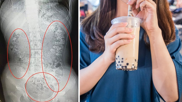 Cai nghiện trà sữa - Hình 2 Cai nghien tra sua-Hinh-2
