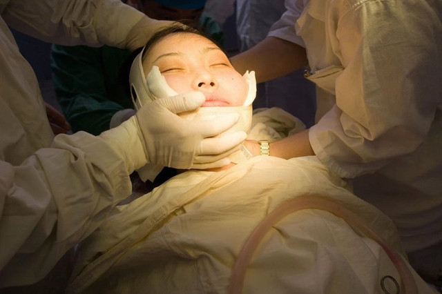 Thượng Hải cấm người dưới 18 tuổi cắt mí, xăm mình Thuong Hai cam nguoi duoi 18 tuoi cat mi, xam minh