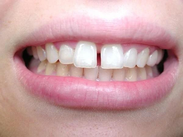 5 nét tướng phụ nữ tiêu tiền như nước - Hình 3 5 net tuong phu nu tieu tien nhu nuoc-Hinh-3