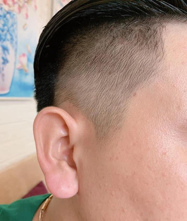 Tướng tai kỵ bấm lỗ, chớ dại tự mình phá tướng Trời ban - Hình 5 Tuong tai ky bam lo, cho dai tu minh pha tuong Troi ban-Hinh-5