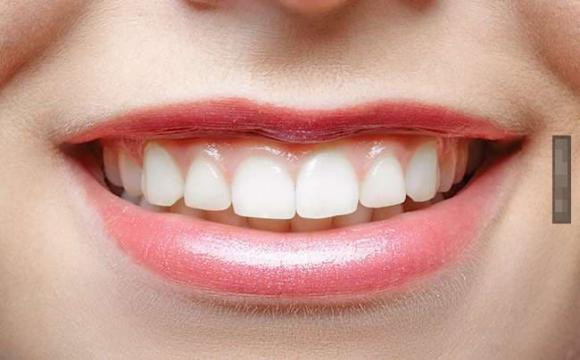 10 'dáng môi' cho bạn thấy được nét tính cách của chính mình - Hình 6 10 'dang moi' cho ban thay duoc net tinh cach cua chinh minh-Hinh-6