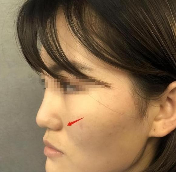 Những cô gái có 'khuôn mặt đau khổ' lộ rõ - Hình 3 Nhung co gai co 'khuon mat dau kho' lo ro-Hinh-3