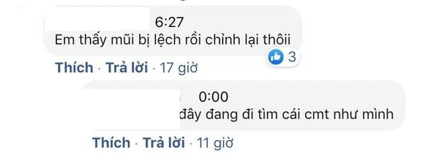 Nam Thư mặt biến dạng, nghi vấn thẩm mỹ hỏng - Hình 10 Nam Thu mat bien dang, nghi van tham my hong-Hinh-10
