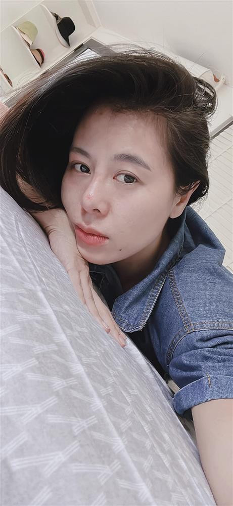 Nam Thư mặt biến dạng, nghi vấn thẩm mỹ hỏng - Hình 7 Nam Thu mat bien dang, nghi van tham my hong-Hinh-7