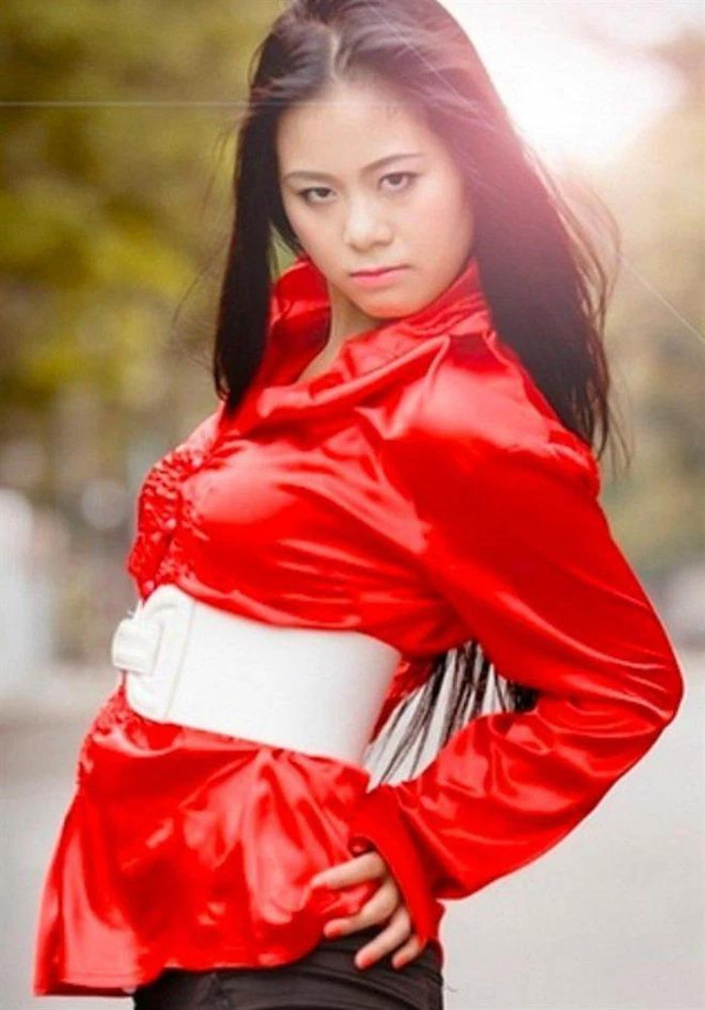 Nam Thư mặt biến dạng, nghi vấn thẩm mỹ hỏng - Hình 11 Nam Thu mat bien dang, nghi van tham my hong-Hinh-11