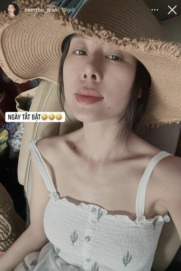Nam Thư mặt biến dạng, nghi vấn thẩm mỹ hỏng - Hình 5 Nam Thu mat bien dang, nghi van tham my hong-Hinh-5