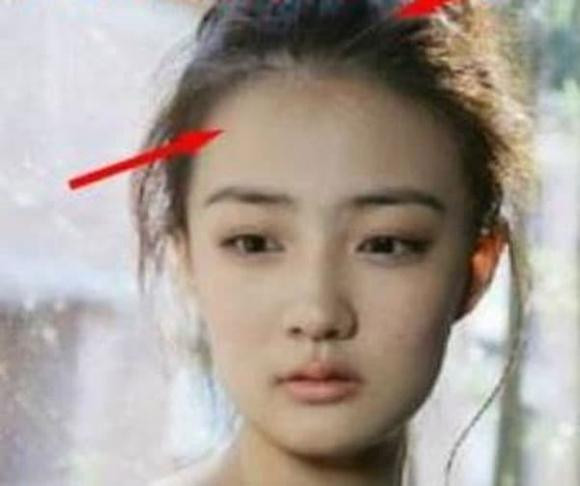 Xem tướng trán: Nhìn vài giây biết ngay cuộc đời phú quý trường thọ - Hình 2 Xem tuong tran: Nhin vai giay biet ngay cuoc doi phu quy truong tho-Hinh-2