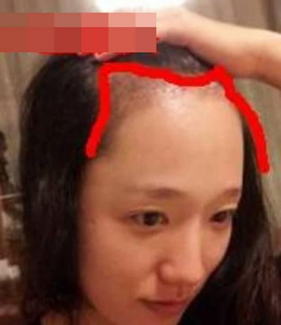 Xem tướng trán: Nhìn vài giây biết ngay cuộc đời phú quý trường thọ - Hình 3 Xem tuong tran: Nhin vai giay biet ngay cuoc doi phu quy truong tho-Hinh-3