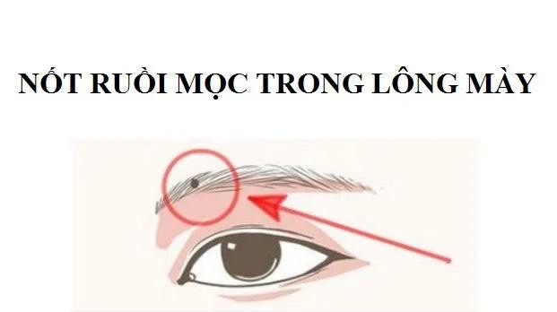 Trẻ có 4 nốt ruồi tượng trưng Tài - Lộc - Phúc, trọn đời may mắn - Hình 2 Tre co 4 not ruoi tuong trung Tai - Loc - Phuc, tron doi may man-Hinh-2