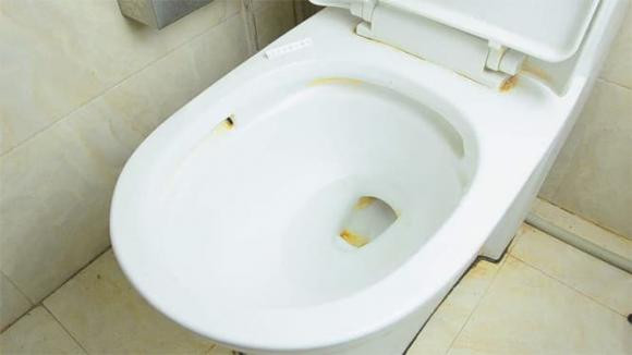 Để biết phụ nữ ở bẩn hay sạch, nhìn "3 chỗ này" là rõ - Hình 4 De biet phu nu o ban hay sach, nhin