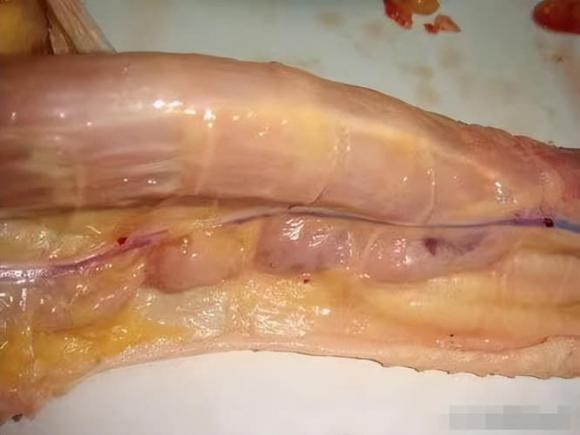 Ba bộ phận này của vịt chứa nhiều 'độc tố' - Hình 4 Ba bo phan nay cua vit chua nhieu 'doc to'-Hinh-4