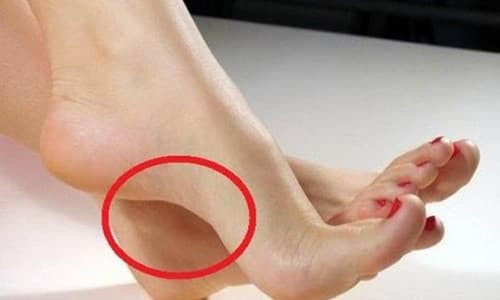 Sở hữu điểm này trên bàn chân, sinh ra đã có số giàu sang - Hình 2 So huu diem nay tren ban chan, sinh ra da co so giau sang-Hinh-2