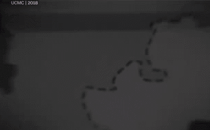 Theo đại diện của DPR và LPR, không có tổn thất nào giữa các lực lượng dân quân; tuy nhiên, những dữ liệu này làm dấy lên một số nghi ngờ đối với các chuyên gia độc lập, vì một số vị trí phòng ngự của dân quân Donbass đã bị phá hủy do các cuộc tấn công của Lực lượng vũ trang Ukraine.