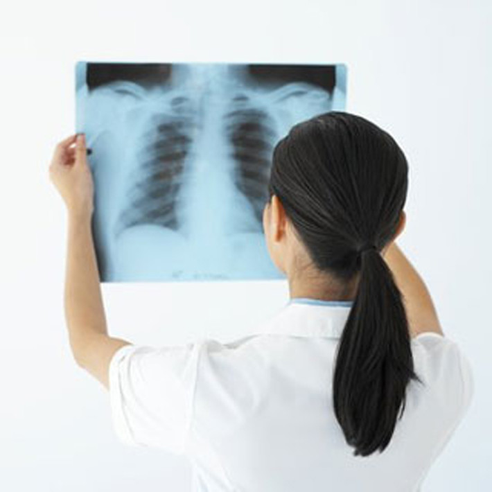 Các nhà khoa học cảnh báo, mẹ bầu thường xuyên chụp X - Quang; tiến hành quét CT cho trẻ cũng là yếu tố làm tăng nguy cơ trẻ phơi nhiễm bức xạ, tăng nguy cơ mắc các loại ung thư.