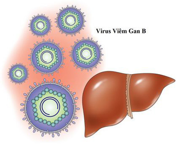 Ngoài ra, nhiễm các loại vi rút như viêm gan B, HIV, Epstein-Barr cũng khiến trẻ đối diện với nguy cơ mắc bệnh cao hơn.