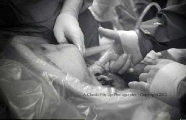 Trong quá trình sinh con, sản phụ phải tuân thủ theo hướng dẫn của bác sĩ, ví dụ như: khi đầu của thai nhi bắt đầu ra, sản phụ ngừng rặn đẻ. Điều này sẽ giúp đảm bảo rằng em bé được sinh ra một cách nhẹ nhàng, nhanh chóng, giảm thiểu tình trạng bị xé rách tầng sinh môn.