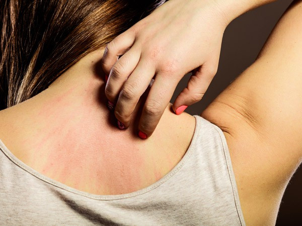 Cẩn trọng với dị ứng da: Hiểu rõ làn da của mình sẽ giúp bạn chọn đúng loại mỹ phẩm, tránh gây dị ứng da. Nếu bạn thấy bất kỳ phản ứng lạ nào của da, hãy đổi loại mỹ phẩm đang dùng ngay./.
