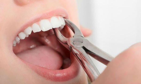 Nhổ răng, phẫu thuật. Trước khi nhổ răng hay thực hiện bất kì một ca phẫu thuật nào, bác sĩ điều muốn biết rằng bạn có đang ở trong chu kỳ hay không. Nếu bạn “đến kì” thì việc nhổ răng hay mổ sẽ khiến máu chảy nhiều hơn do khả năng kết đông của máu giảm, nếu không kiểm soát được thì có thể xảy ra biến chứng nguy hiểm.
