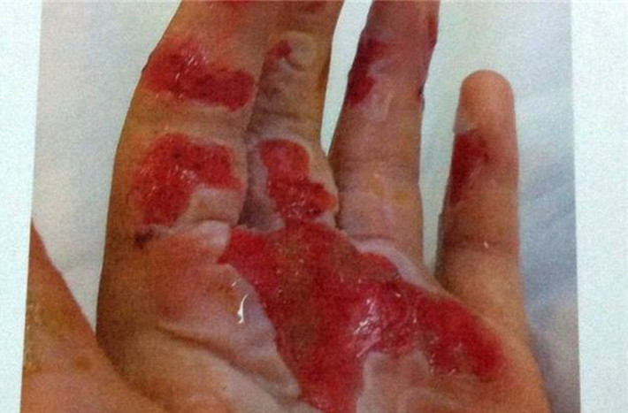Đá khô lạnh gấp nhiều lần so với đá nước. Đây cũng là điểm khác biệt lớn giữa đá khô và đá nước thông thường. Đá khô được tạo thành từ khí CO2 trong quá trình sản xuất công nghiệp. Chúng được nén thành dạng rắn ở áp suất cao và có nhiệt độ rất thấp (khoảng - 78,5 độ C).