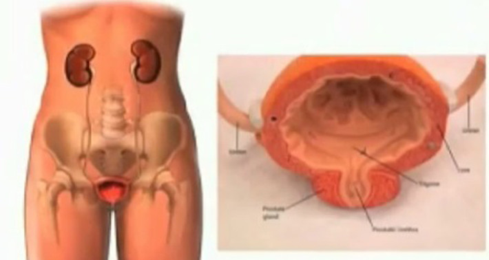 Trong quá trình thử nghiệm mẫu máu chứa 8 hợp chất gây ung thư, nghiên cứu phát hiện hàm lượng hóa chất o-và m-toluidine ở các nhân viên làm tóc khá cao. Chính vì vậy, các chuyên gia khuyên nhân viên làm tóc nên có biện pháp phòng ngừa cần thiết trong quá trình làm việc phục vụ khách hàng.