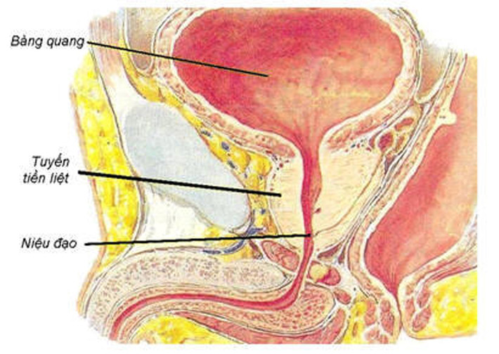Hiện lượng người mắc ung thư tiền liệt tuyến ngày càng tăng. Theo Cancer Registry Singapore, chỉ tính riêng nước này, có 3.456 trường hợp được chẩn đoán mắc mới trong thời gian từ 2009 – 2013. Hiện ung thư tiền liệt tuyến phổ biến thứ ba trong số các loại ung thư tấn công nam giới, gây ra lượng tử vong cao thứ 5 trong các loại ung thư tại Singapore.
