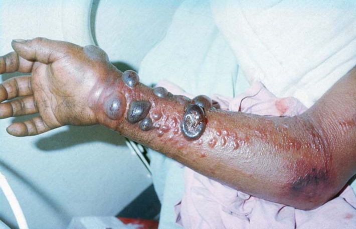 Với cơ chế lây lan này, cách tốt nhất để phòng ngừa là không tiếp xúc với virus gây bệnh. Những người đang có ý định đến châu Phi cần tìm hiểu rõ vùng đất mình đến có ổ dịch hay không thông qua các trang web của trung tâm kiểm soát và phòng chống Ebola.