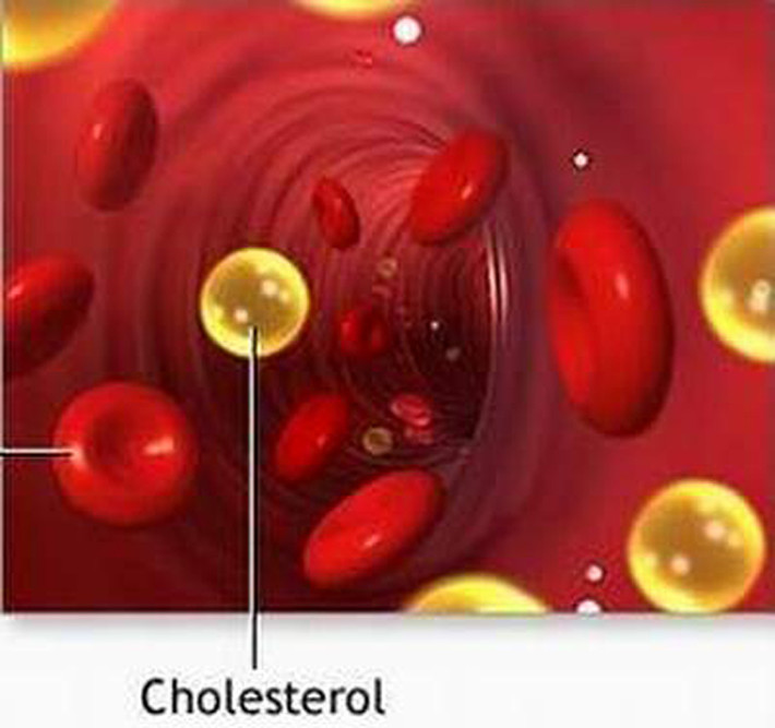 Trong khi đó, niacin và lượng chất xơ ở loại quả này có khả năng giảm nồng độ cholesterol ở máu.