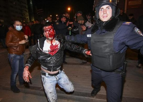 Cảnh sát Donetsk hộ tống một người đàn ông bị thương nặng ra khỏi cuộc ẩu đả giữa người biểu tình thuộc hai phe, một ủng hộ Moscow và một ủng hộ chính phủ mới ở Kiev.