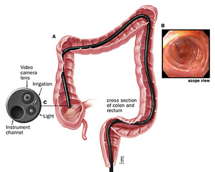 Tuy nhiên, một trong những bất lợi của chị em thời mãn kinh là sự thiếu hụt estrogen dẫn đến giảm ham muốn tình dục, khô âm đạo. Dù vậy, bạn không nên chấm dứt mọi thứ ở đây. Hãy cùng đối tác tìm ra các điểm kích thích, tư thế mới cũng như cách để cả hai cùng thỏa mãn. Nếu quá khó khăn, hãy tận dụng kem bôi trơn để dễ dàng khởi động hoặc đồ chơi tình dục để tăng hứng thú khi “yêu”.