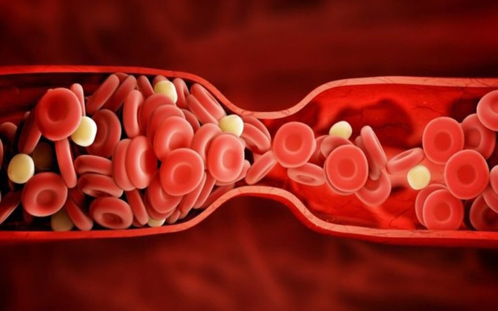 Máu: Virus corona cũng làm máu trở nên đặc hơn và tạo ra các cục máu đông trong tĩnh mạch, các cục máu đông có thể vỡ ra và di chuyển đến phổi và não gây tắc nghẽn.