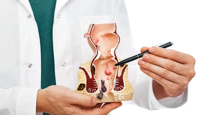 Cách phòng ngừa bệnh trĩ hiệu quả 