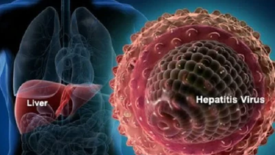 Cách nhận biết triệu chứng virus viêm gan có thể gây tử vong