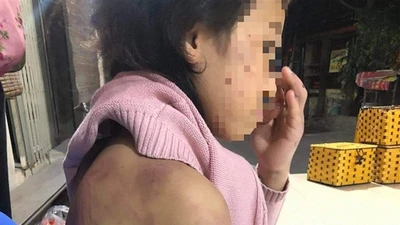 Bé gái 12 tuổi nghi bị bạo hành, xâm hại tình dục: Cục Trẻ em lên tiếng
