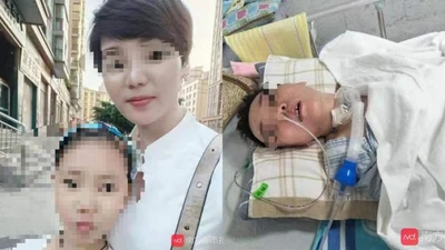 Những trường hợp hôn mê sâu vì đụng dao kéo làm đẹp