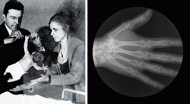 3. Bạn có sức mạnh siêu phàm khi mới đẻ: Trẻ sơ sinh rất khỏe so với kích thước và trọng lượng cơ thể. Nếu cho một đứa trẻ nắm thanh ngang, nó có thể đu trên đó một thời gian dài mà không thấy mệt. Phản xạ nắm bắt lòng bàn tay này được thừa hưởng từ tổ tiên của chúng ta khi những con khỉ mới sinh phải ôm lấy mẹ của chúng, nắm lấy tóc của mẹ. Từ 3 tháng tuổi, trẻ sơ sinh thường mất khả năng này.