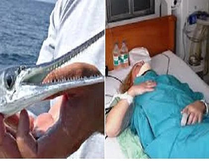 Soi loài cá khiến du khách Nga gặp nạn tại Việt Nam