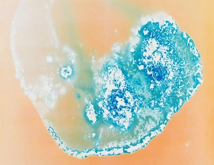 Ma túy có hình dáng thế nào dưới kính hiển vi 