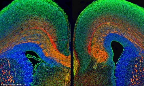 Hình ảnh rực rỡ khó tin về... cấu trúc não bộ